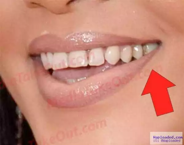 Irritating!! See What Excessive Weed Smoking Has Done To Rihanna’s teeth